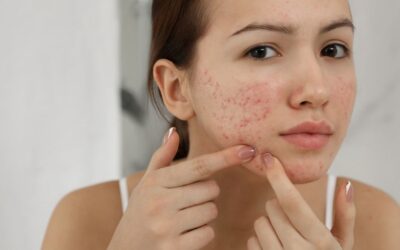 Chamomile essential oil: benefits, uses, and recipes for skin problems