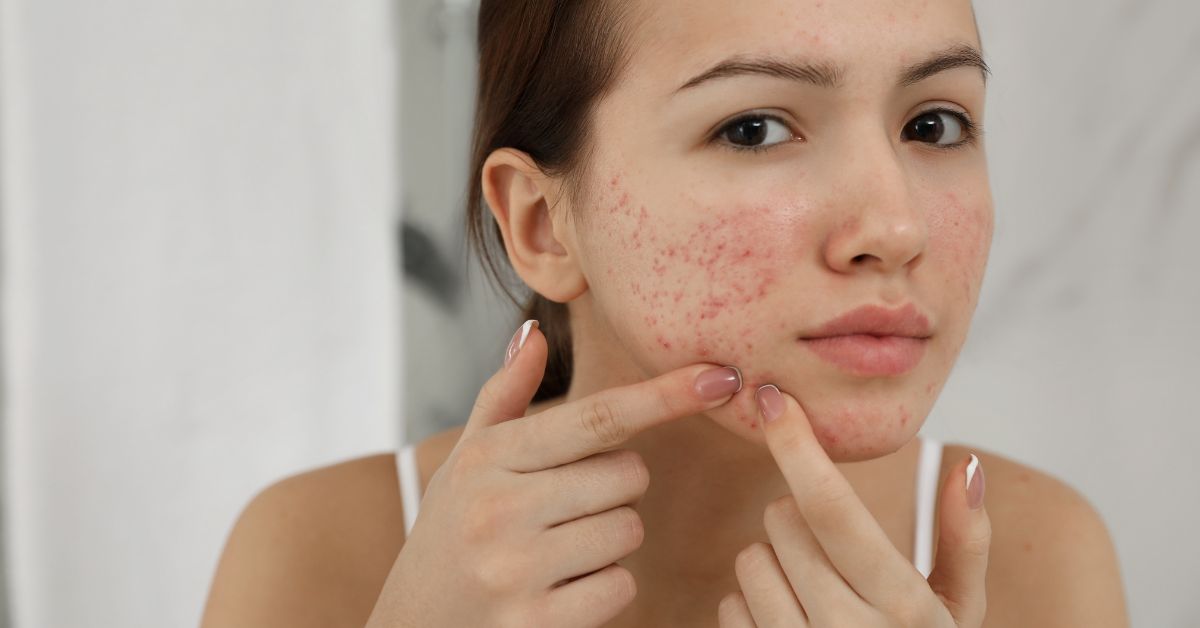 skin-problems